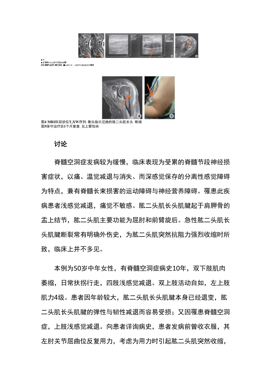 显微外科医师晋升副主任（主任）医师例分析专题报告（肱二头肌长头腱断裂）.docx_第3页