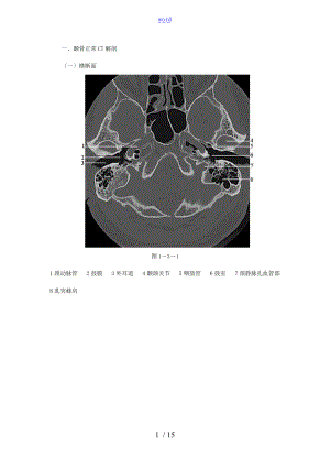 颞骨正常CT解剖附图.doc