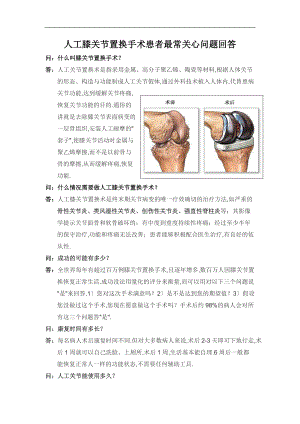 人工膝关节置换术宣教手册.doc