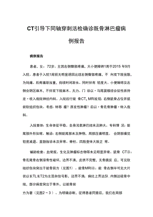 CT引导下同轴穿刺活检确诊骶骨淋巴瘤病例报告.docx