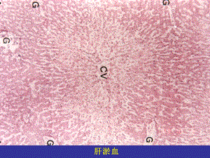 病理学实习镜下局部血液循环障碍.ppt
