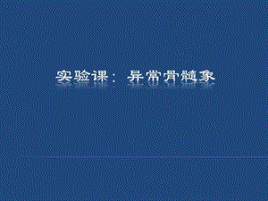 异常骨髓象.ppt