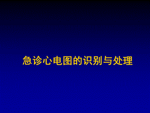 急诊心电图识别与处理名师编辑PPT课件.ppt