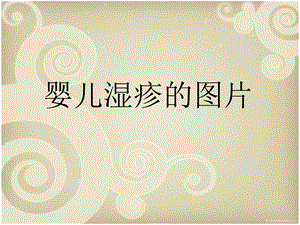 婴儿湿疹的图片名师编辑PPT课件.ppt