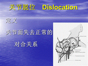 关节脱位.ppt
