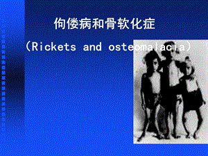 佝偻病和骨软化症.ppt