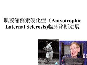 肌萎缩侧索硬化临床诊断进展.ppt