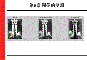 第5章医学图像的复原.ppt