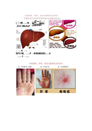 综合望诊《肝胆疾病》详解.docx