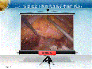 直肠的局部解剖与腹腔镜“场景”理念下的手术操作技巧（2） .ppt