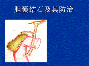 胆囊结石及防治.ppt