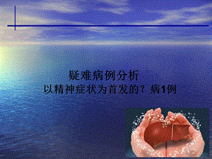 肝豆状核变性病例医学幻灯片.ppt