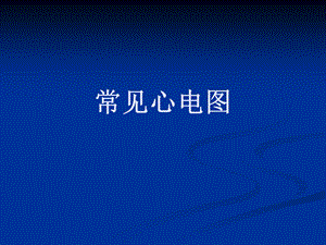[整理版]心电图,三基培训.ppt
