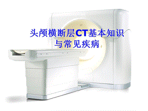 头颅CT基本知识与常见疾病.ppt