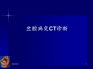 女性生殖系统疾病CT诊断.ppt