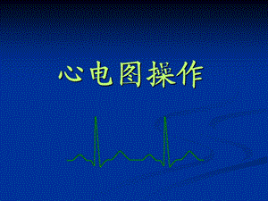 心电图操作规范.ppt