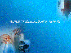珠网膜下腔出血与动脉瘤.ppt