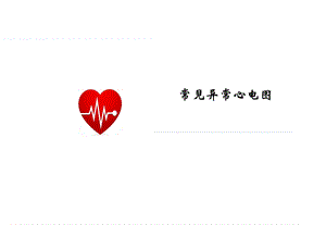 常见异常心电图(修改版).ppt