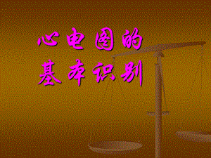 快速心电图入门.ppt