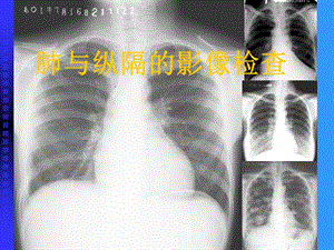 肺与纵隔的影像检查.ppt