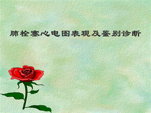肺栓塞心电图表现及鉴别诊断.ppt