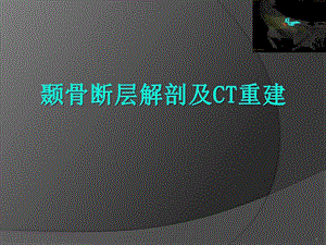 颞骨断层解剖及CT三维重建.ppt