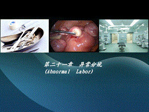 八制胎位异常.ppt
