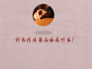 针灸疗法禁忌症是什么.ppt