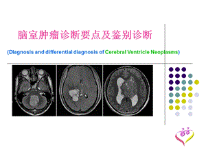 脑室肿瘤诊断要点及鉴别诊断.ppt