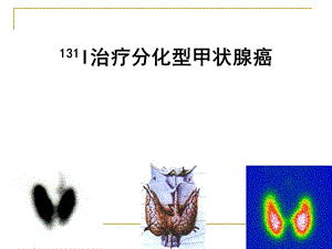 治疗分化型甲状腺癌.ppt
