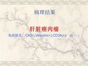 肝脏肿瘤.ppt