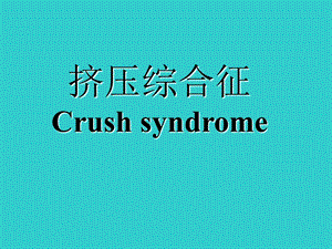 挤压综合征.ppt