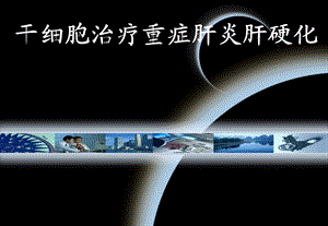 干细胞治疗重症肝炎肝硬化.ppt