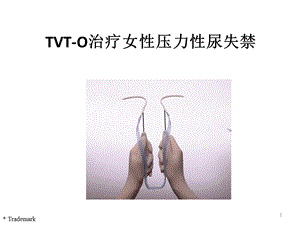 TVTO治疗女性压力性尿失禁.ppt