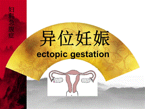 异位妊娠(输卵管妊娠)PPT.ppt.ppt