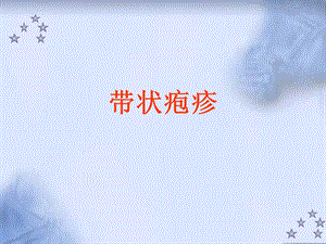 医院带状疱疹.ppt