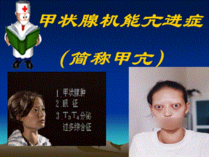 甲亢.脂代最新修.ppt