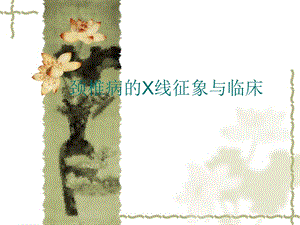 颈椎病的X线征象与临床.ppt