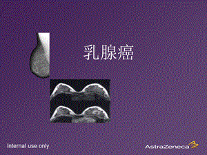 2-乳腺癌基础知识.ppt
