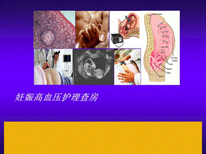 妊娠高血压护理查房新...ppt