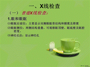 五官影像学检查.ppt
