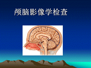 脑血管病的影像学检查.ppt