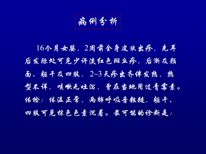 传染病学麻疹.ppt