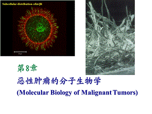 恶性肿瘤的分子生物学.ppt