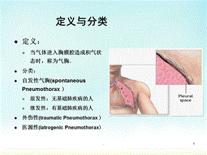 气胸医学PPT课件.ppt