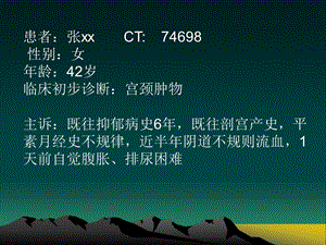 子宫肌瘤影像学诊断.pptx