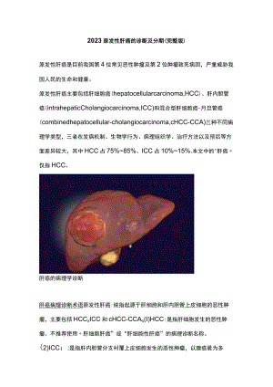2023原发性肝癌的诊断及分期（完整版）.docx