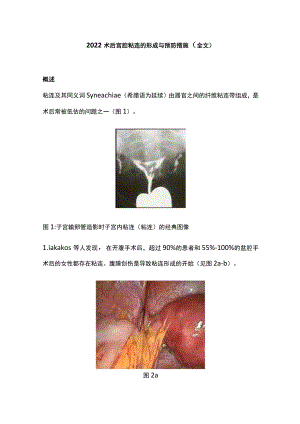2022术后宫腔粘连的形成与预防措施（全文）.docx