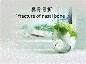 鼻骨骨折医学PPT课件.pptx