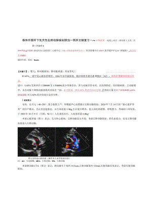 非体外循环下先天性右肺动脉缺如矫治一例并文献复习修改见批注！.docx